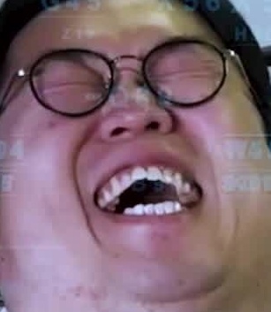Face