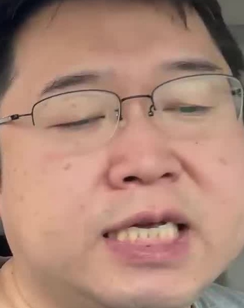 Face