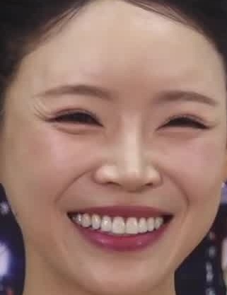 Face