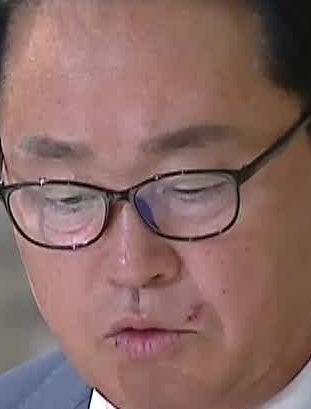 Face
