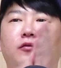 Face