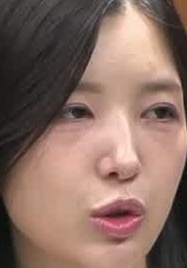 Face