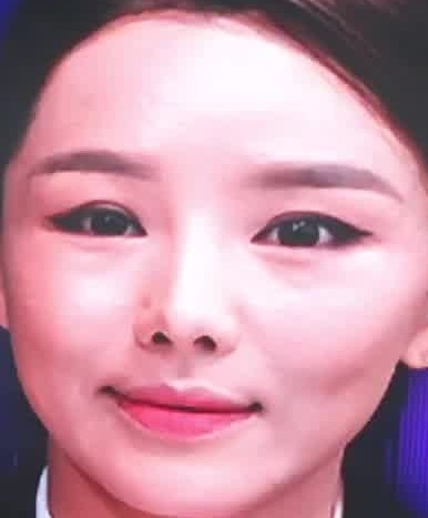 Face