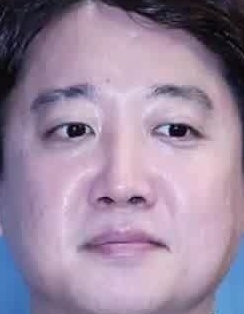 Face