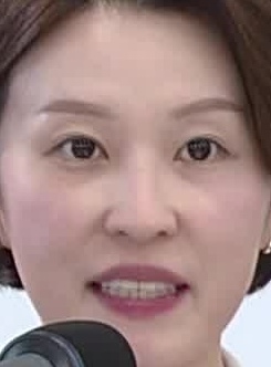 Face