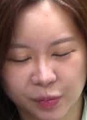 Face