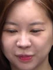Face