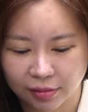 Face