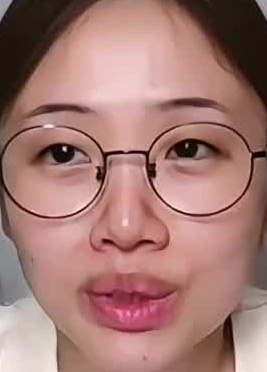 Face