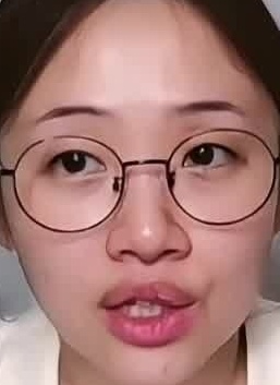 Face