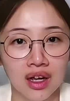 Face