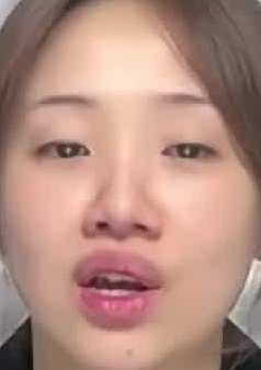 Face
