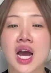 Face