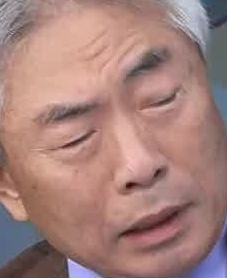 Face
