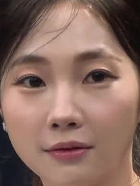 Face