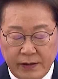 Face