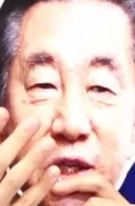Face