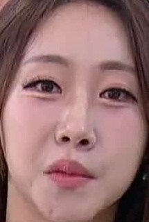 Face