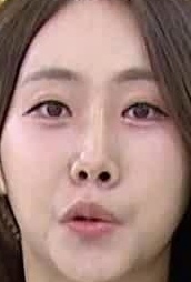 Face
