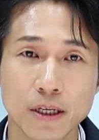 Face