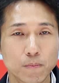 Face