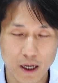 Face