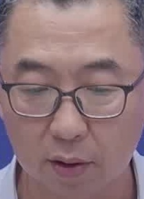 Face