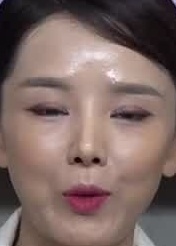 Face