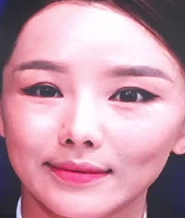 Face