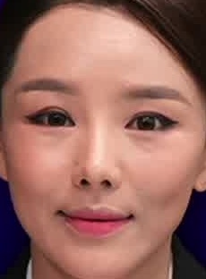 Face