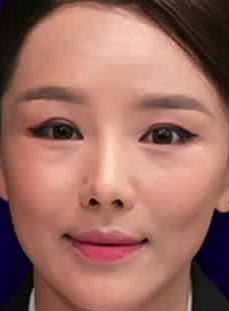 Face