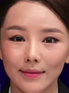 Face