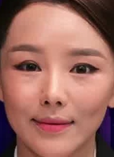 Face