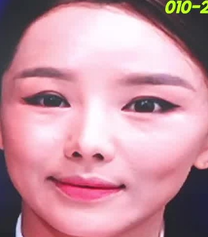 Face