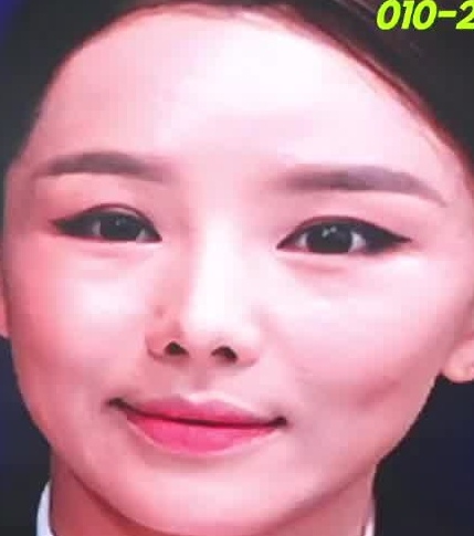 Face