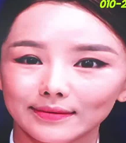 Face