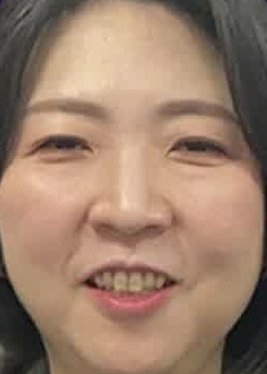 Face