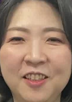 Face