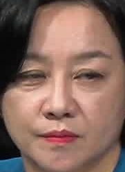 Face