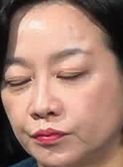Face