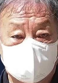 Face