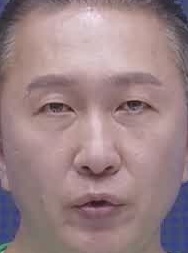 Face