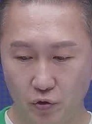 Face
