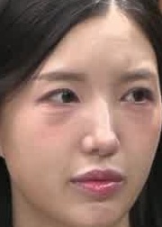 Face