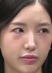 Face