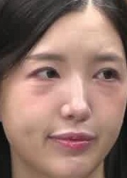 Face