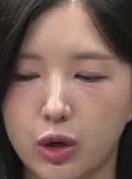Face