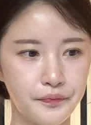 Face