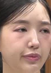 Face