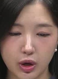 Face